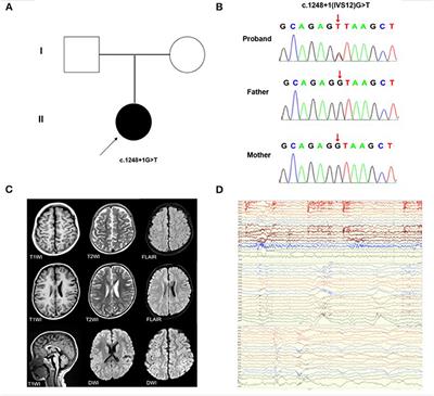 Case Report: A Novel KMT2E Splice Site Variant as a Cause of O'Donnell-Luria-Rodan Syndrome in a Male Patient